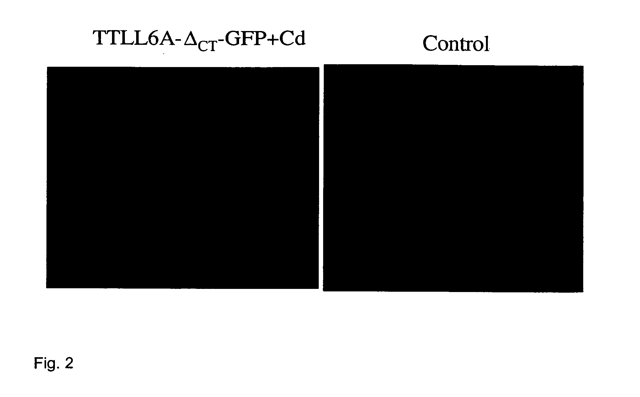 Biological system and assay for identifying inhibitors of tubulin glutamylases