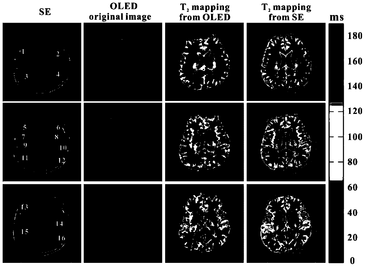 A Residual Network-Based Quantitative T for Single-Scan Magnetic Resonance  <sub>2</sub> Image reconstruction method