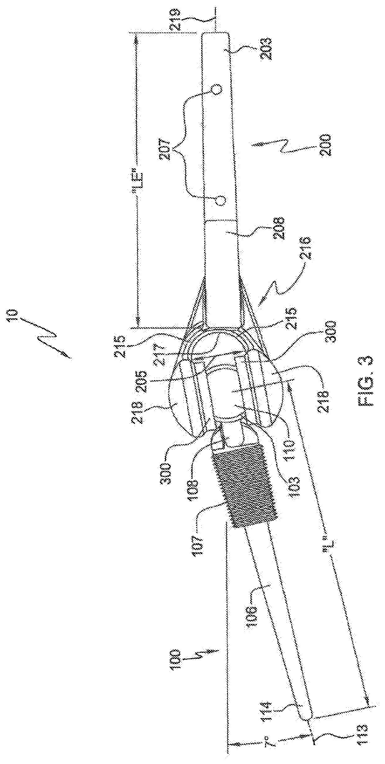 Elbow prosthesis and method of use