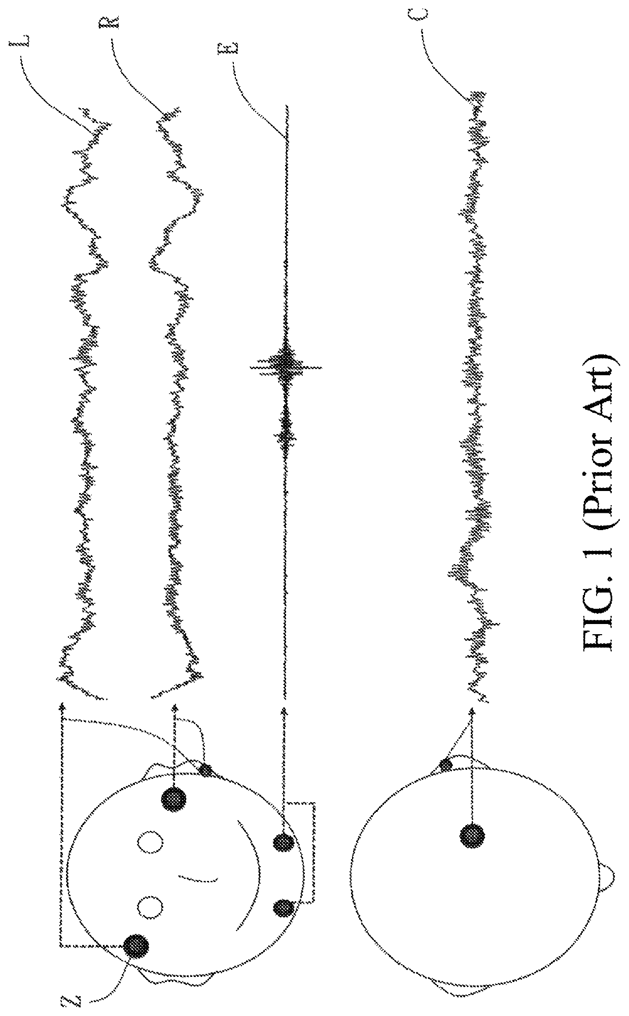 EOG-based sleep staging method, computer program product with stored programs, computer readable medium with stored programs, and electronic apparatuses