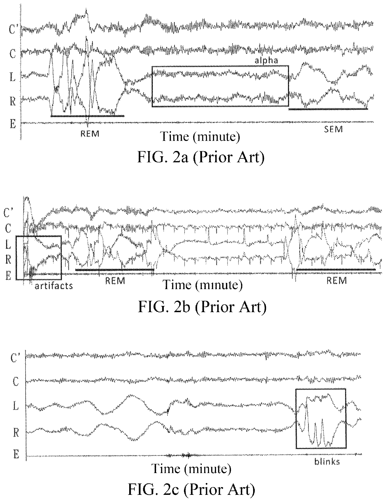 EOG-based sleep staging method, computer program product with stored programs, computer readable medium with stored programs, and electronic apparatuses