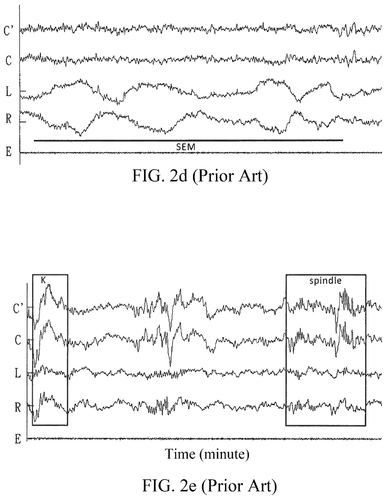 EOG-based sleep staging method, computer program product with stored programs, computer readable medium with stored programs, and electronic apparatuses