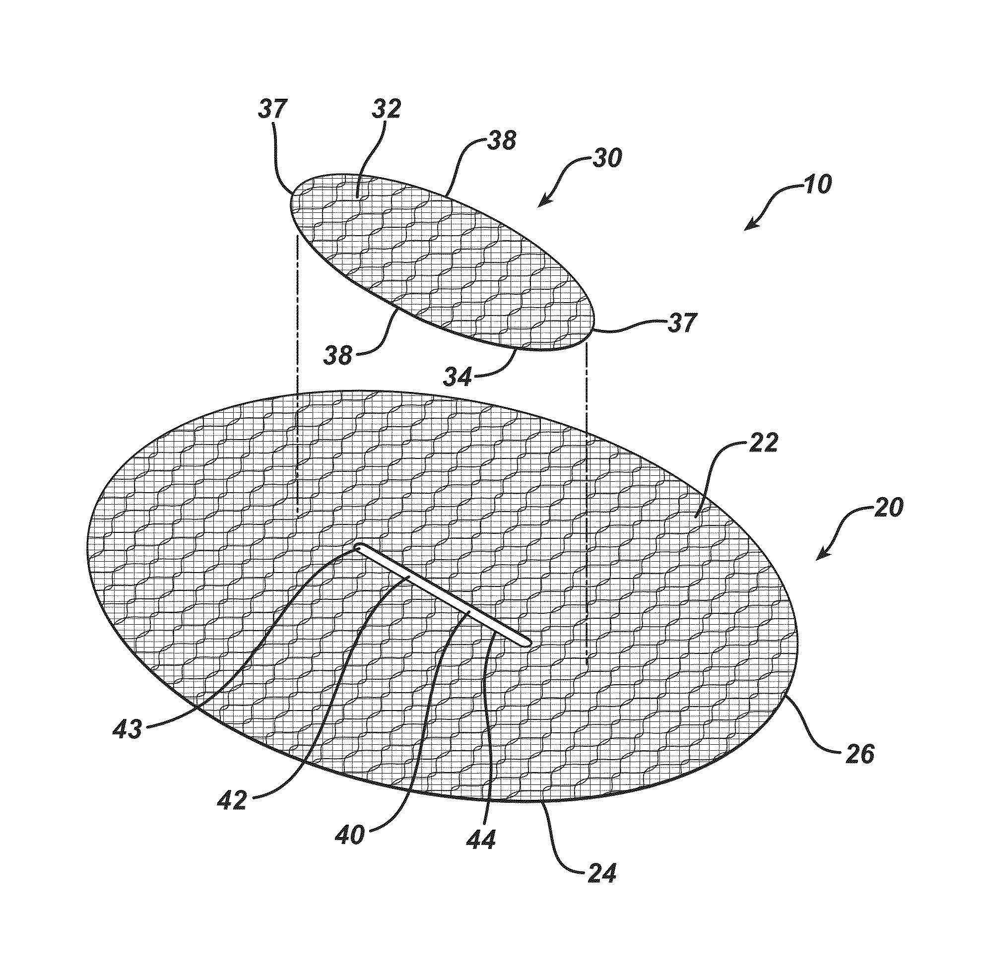 Single plane tissue repair patch