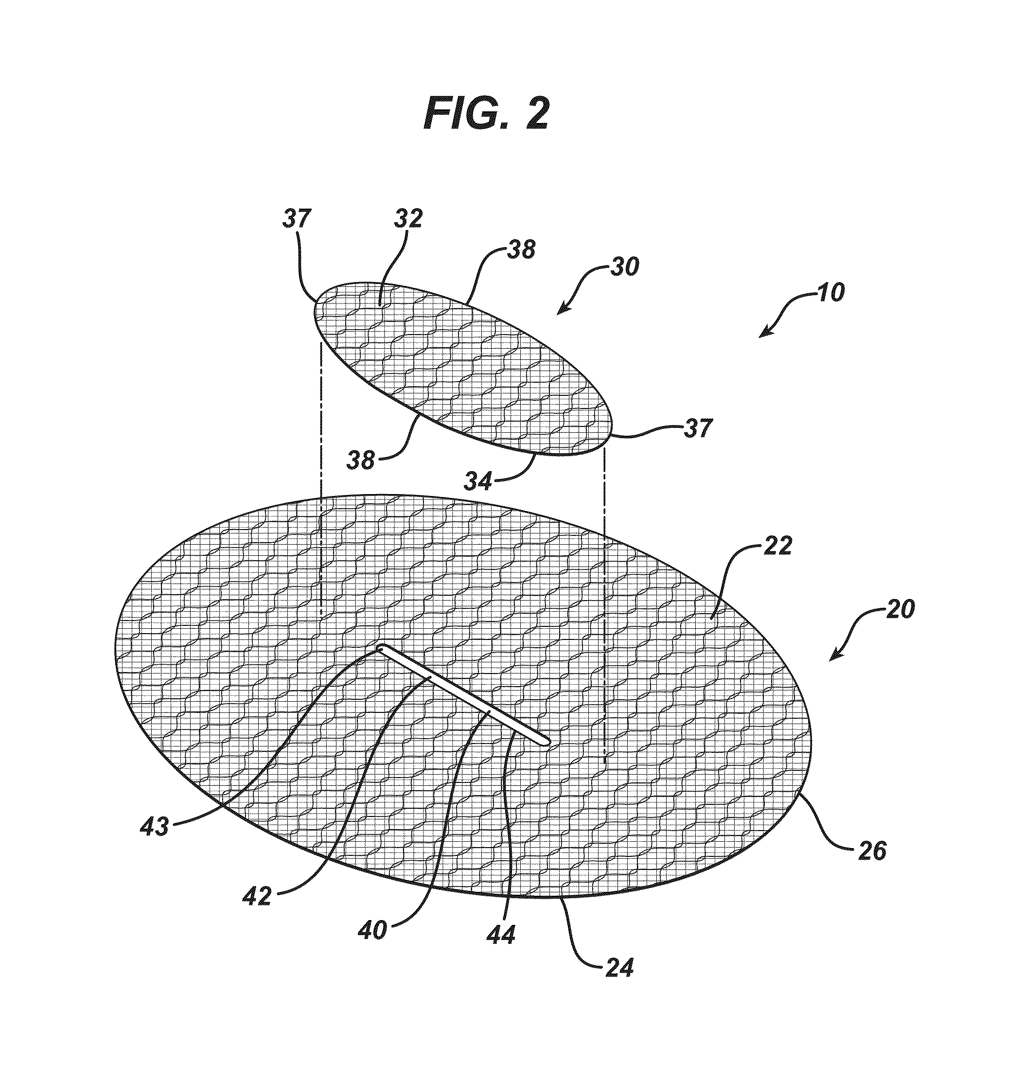 Single plane tissue repair patch