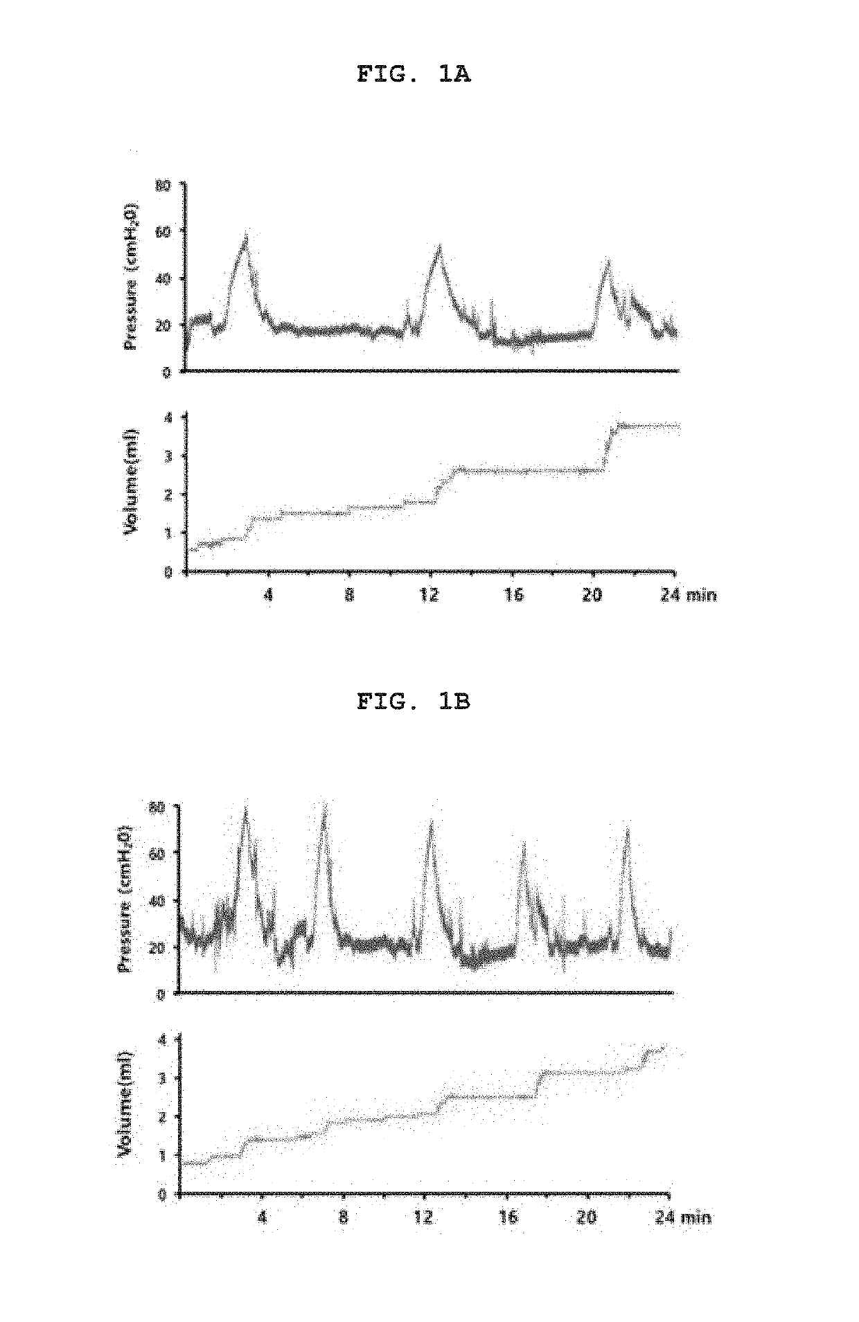 Biomarker for diagnosing overactive bladder disease and screening method of therapeutic agents using the same