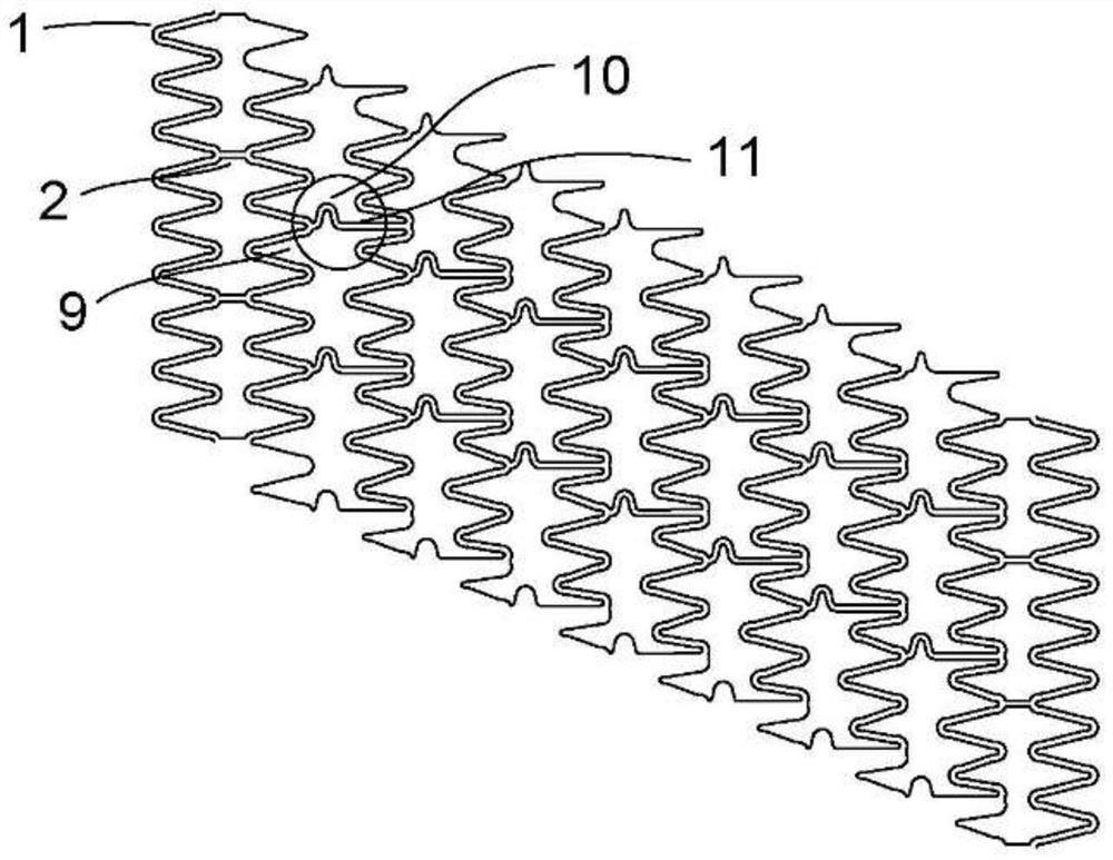 Absorbable zinc-based alloy drug-loaded stent