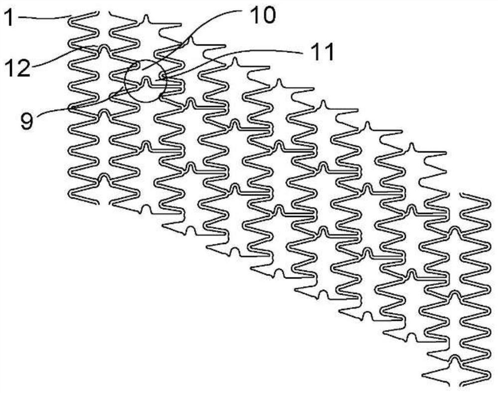 Absorbable zinc-based alloy drug-loaded stent