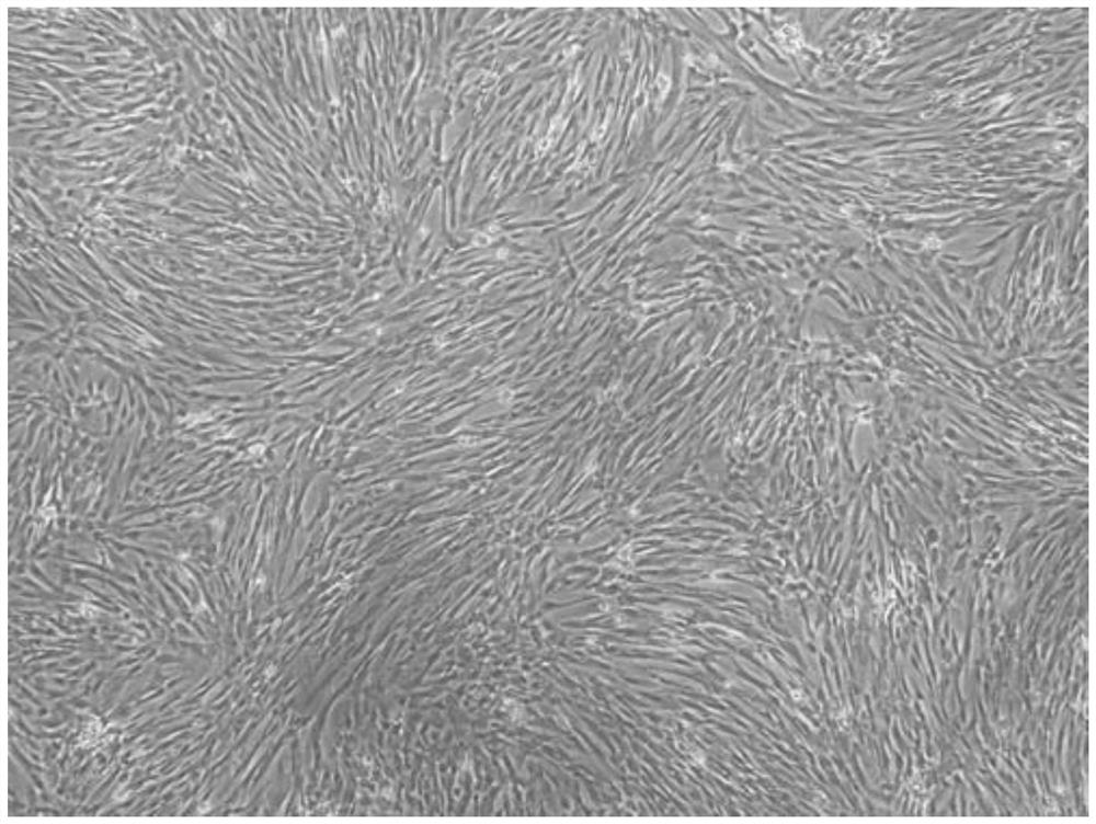 A method for isolating human placental chorionic mesenchymal stem cells