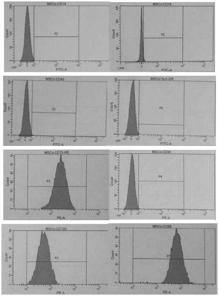 A method for isolating human placental chorionic mesenchymal stem cells