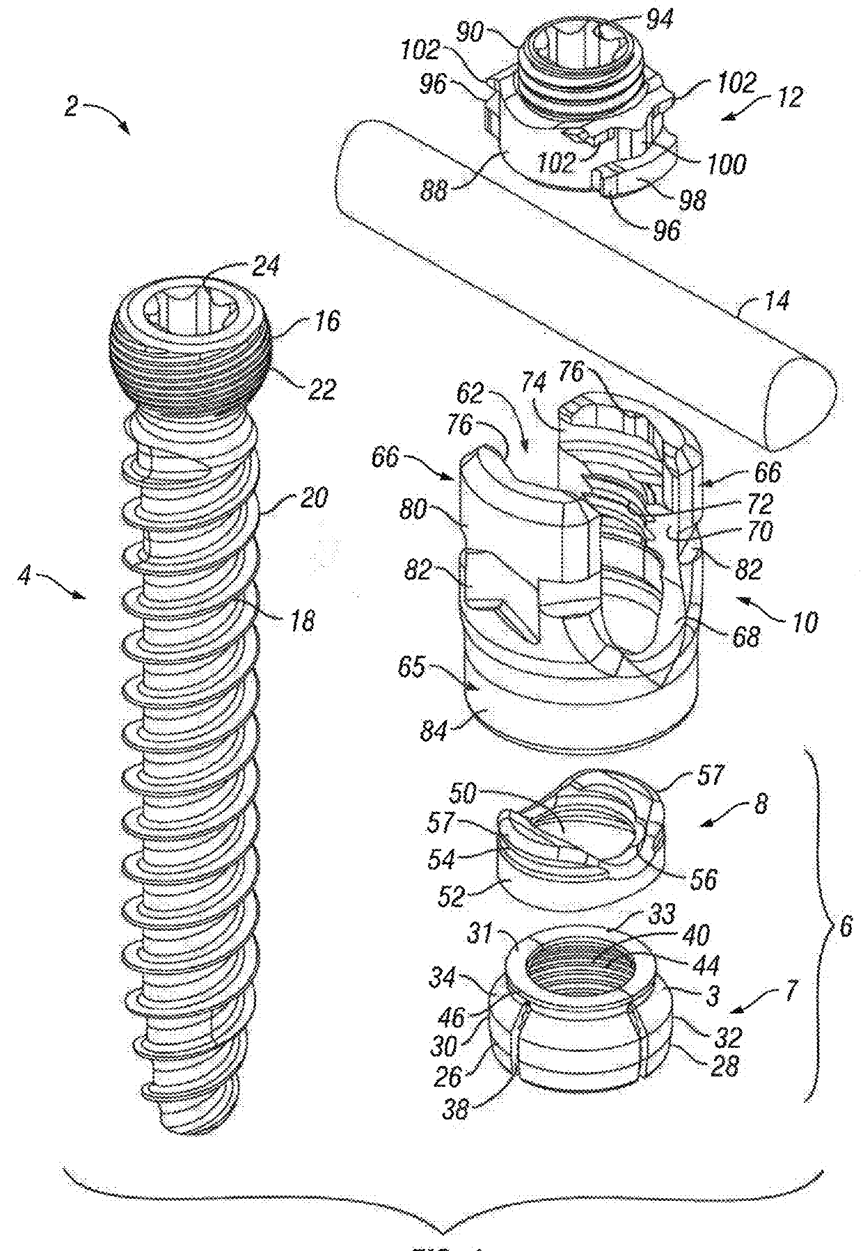 Orthopedic fixation devices and methods of installation thereof