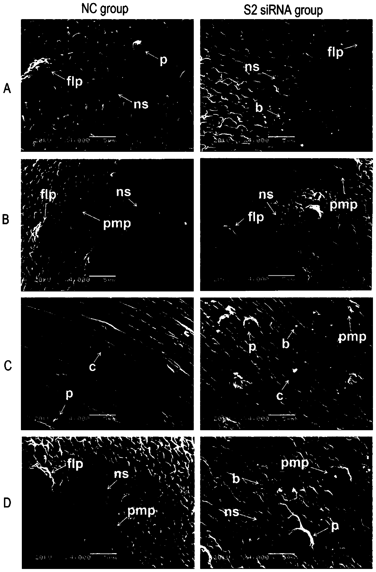 siRNA of schistosoma japonicum katsurada SjLwr gene and application thereof