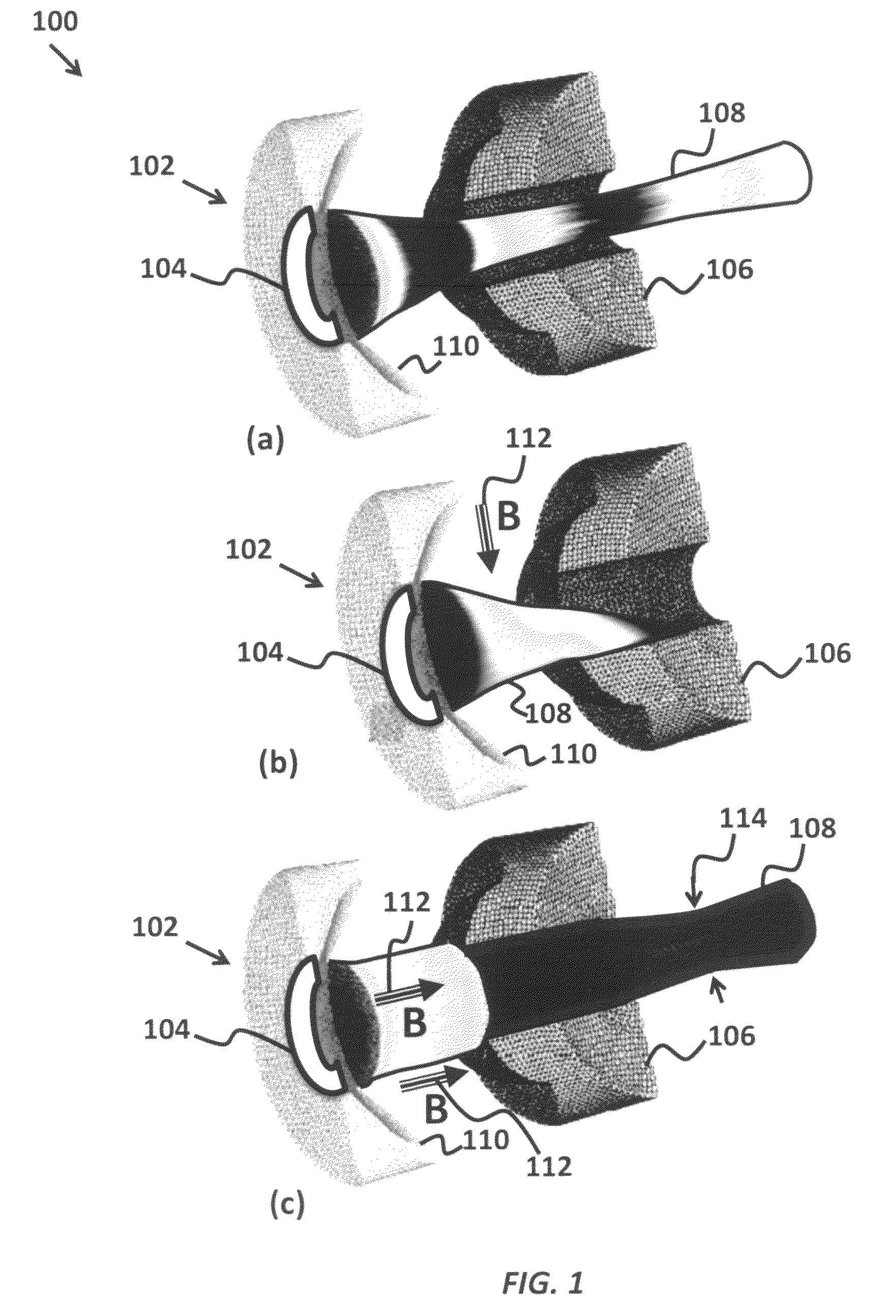 Configurations for integrated MRI-linear accelerators