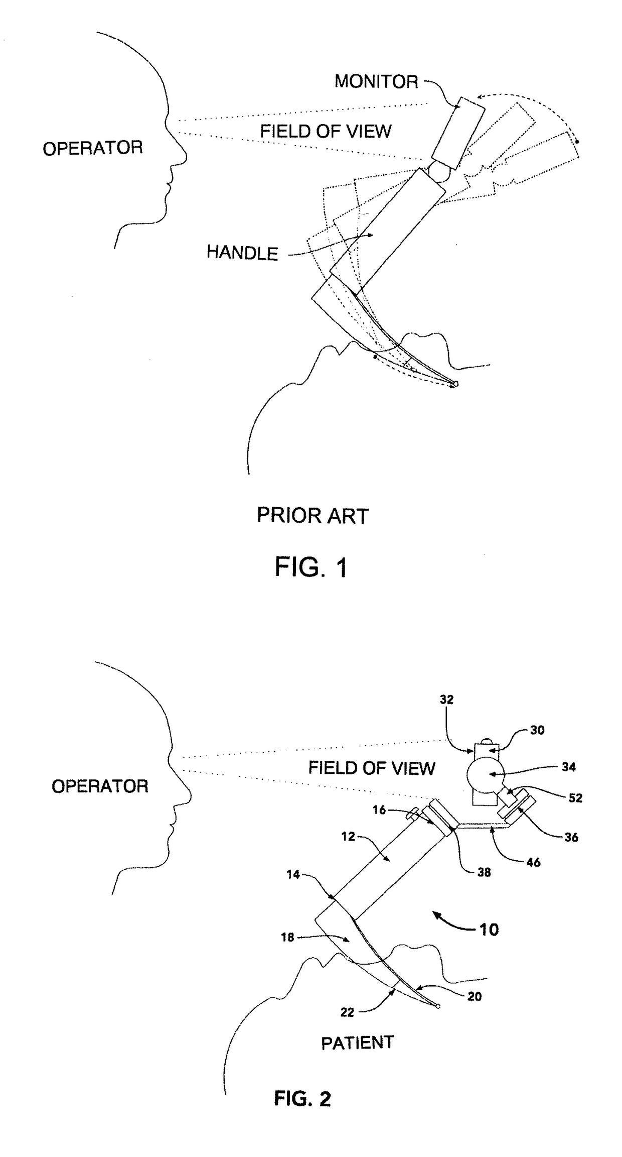 Video laryngoscope with monitor stabilization