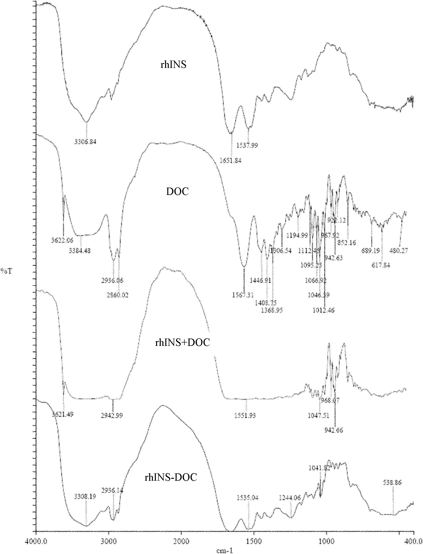 Insulin nanoparticle and preparation method thereof