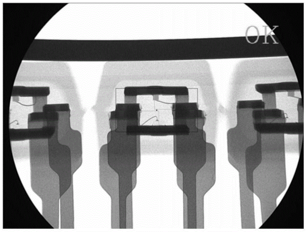 IC component defect detection method based on X-Ray image