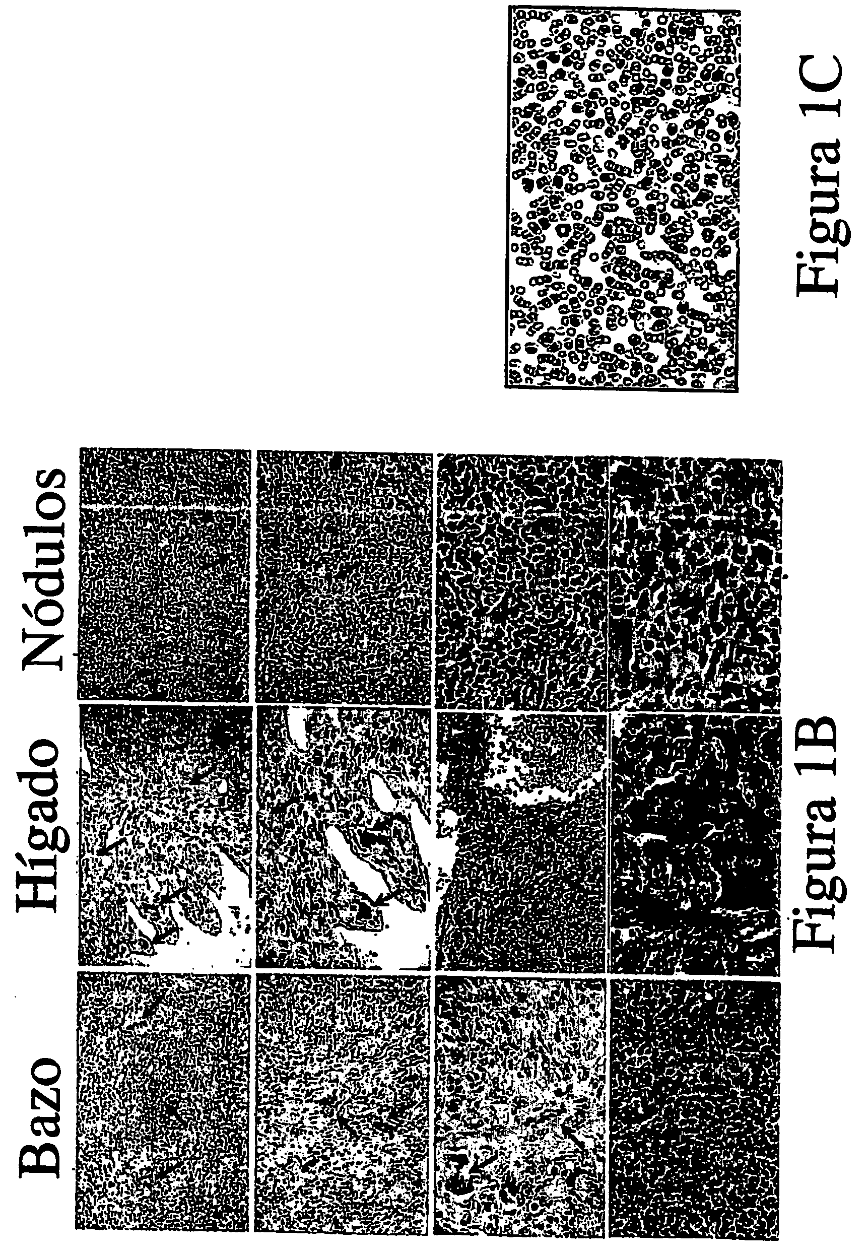 Transgenic non-human mammals as models for human pathologies of stem cell origin