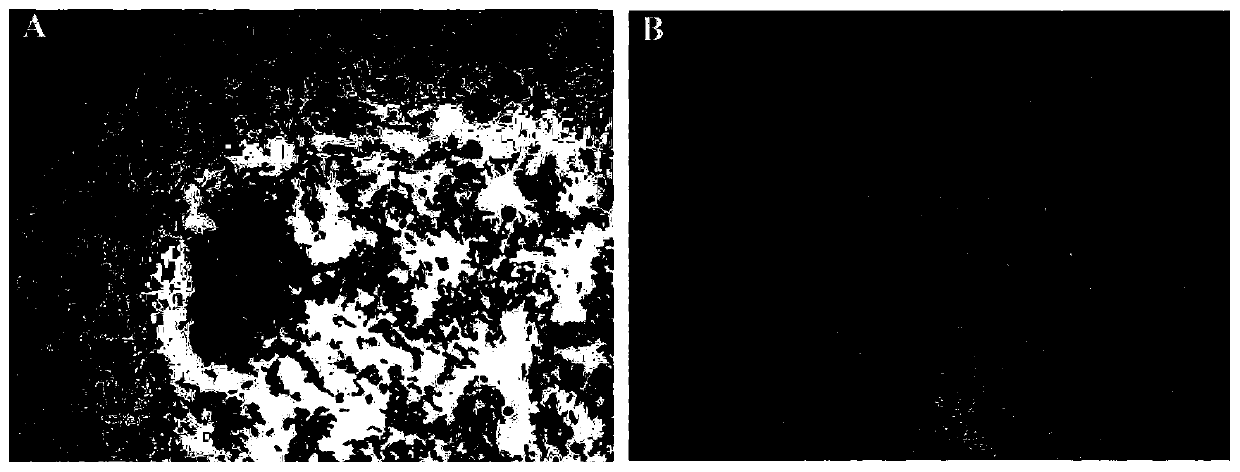 Brevibacillus laterosporus, antibacteriallipopeptide and application thereof to agriculture and food