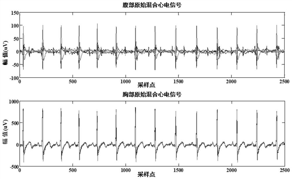 Multi-lead fetal electrocardiogram extraction device based on factor synchronism analysis