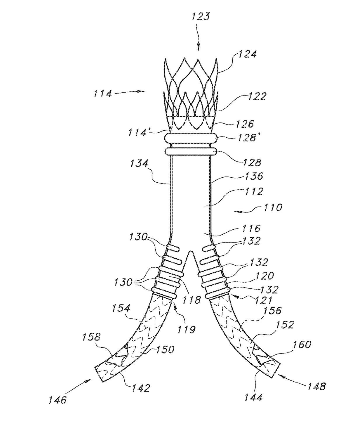 Endovascualr graft for aneurysms involving major branch vessels