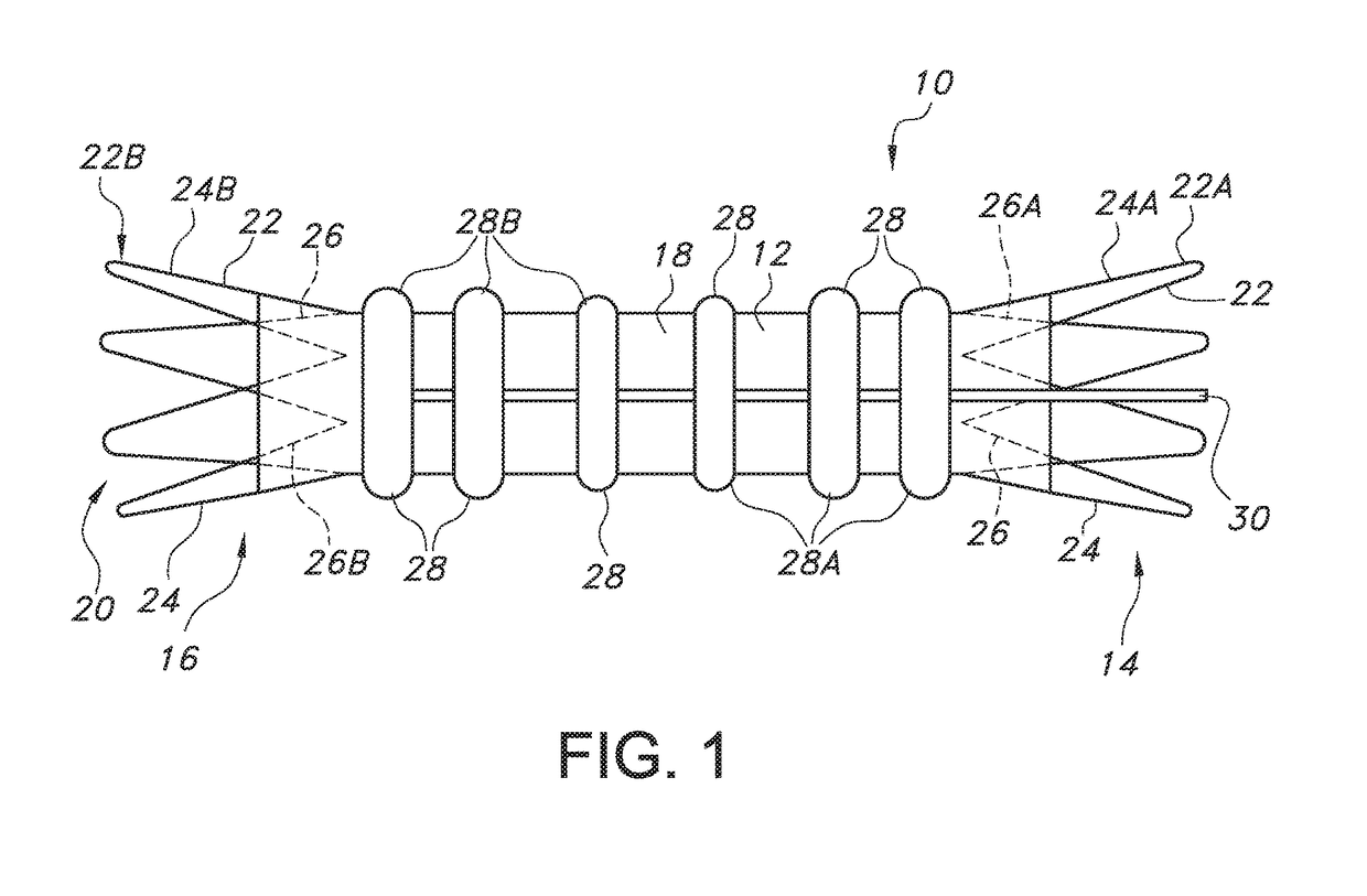 Endovascualr graft for aneurysms involving major branch vessels