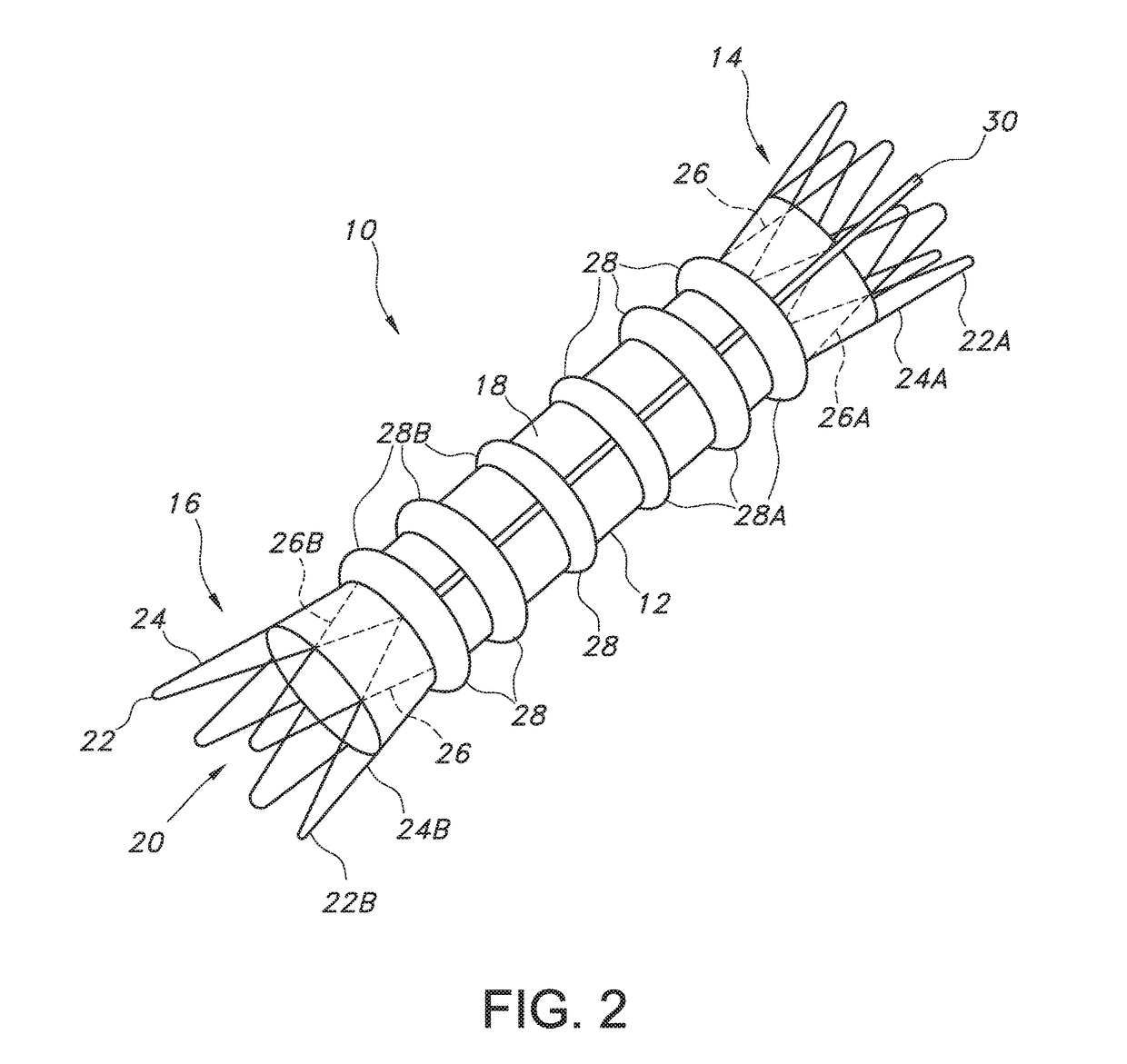 Endovascualr graft for aneurysms involving major branch vessels