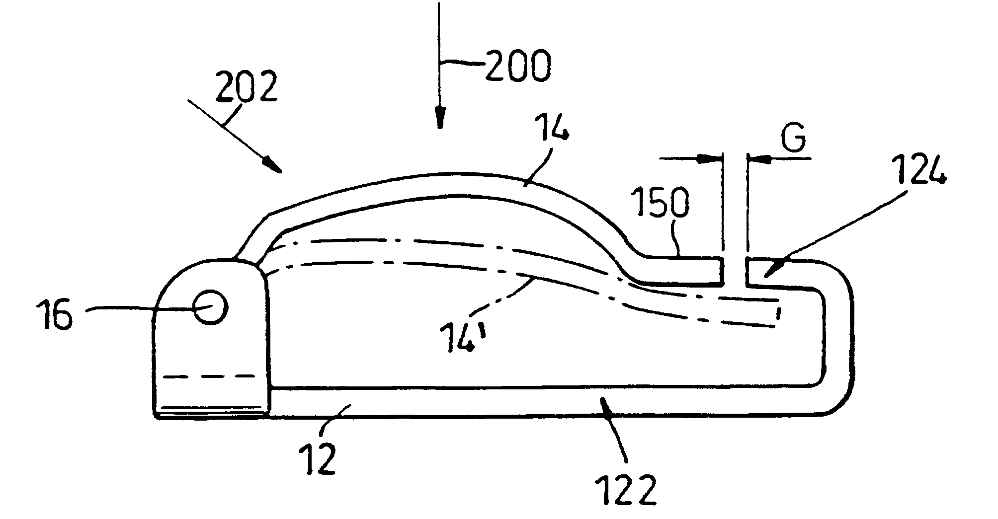 Sterilization and ligation clips