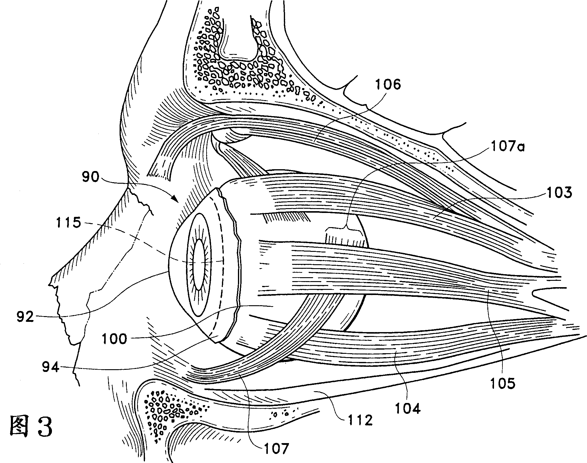 Ophthalmic drug delivery device