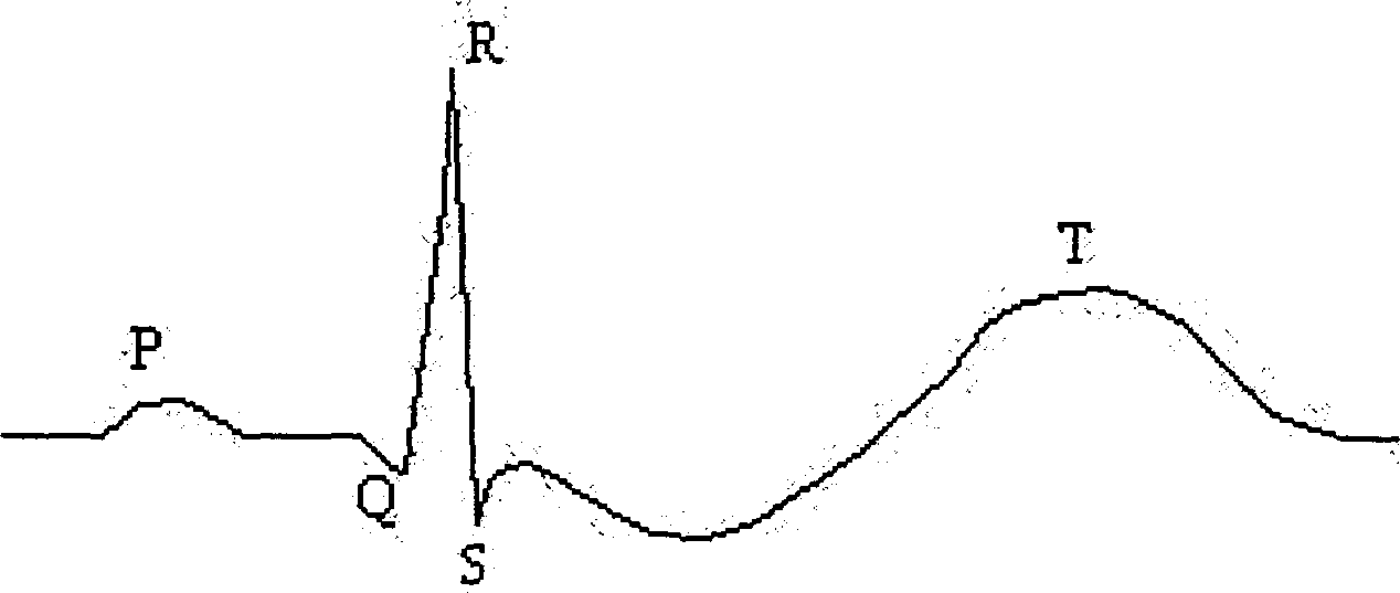 Alternating T-wave measuring method and device for sports electrocardiogram