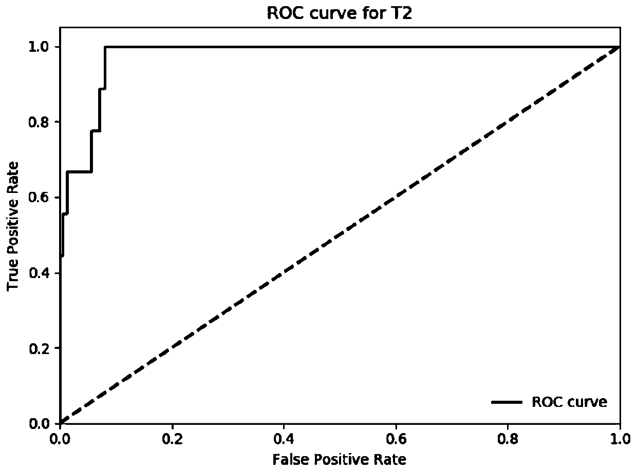 Training method of Faster RCNN (Recurrent Convolutional Neural Network) for enhancing automatic identification of CT (Computed Tomography) image of gastric cancer