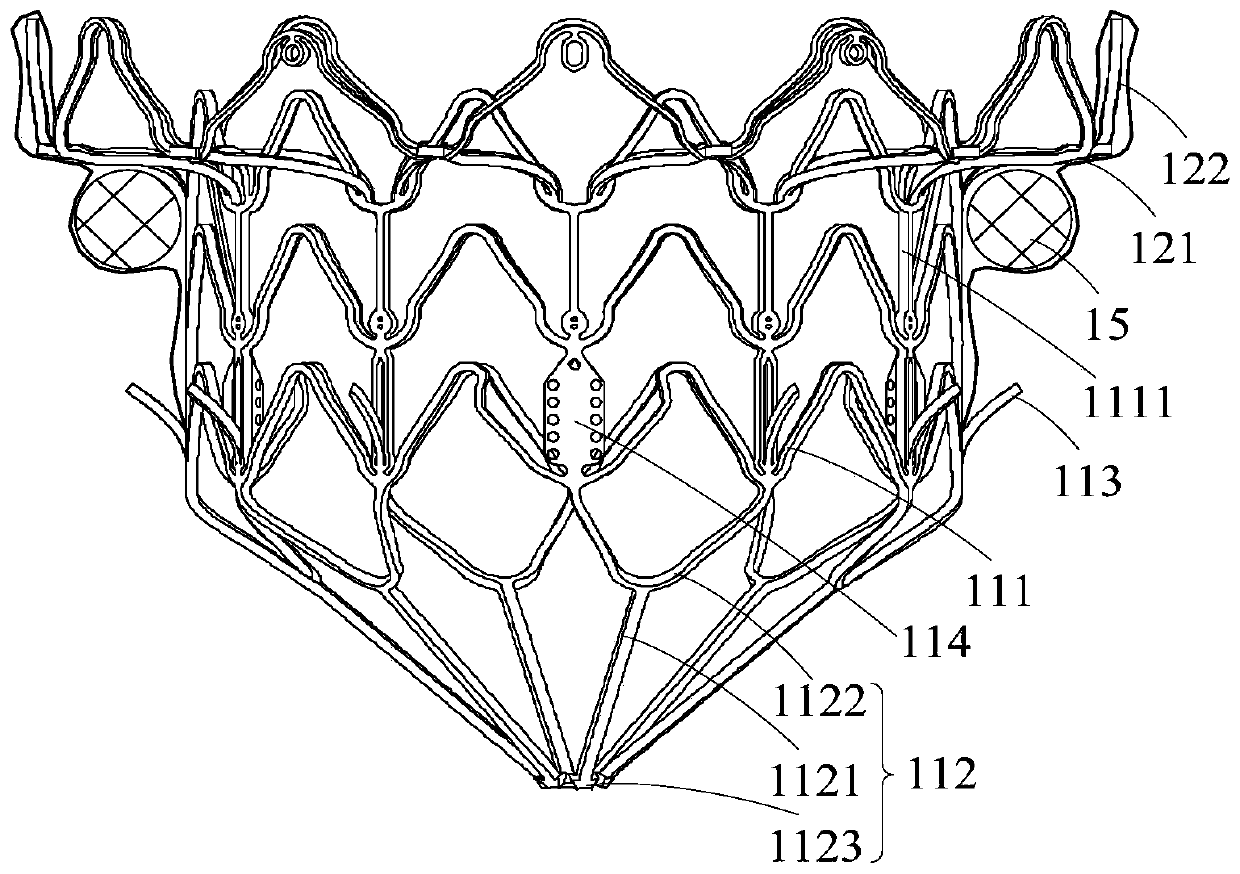 Heart valve