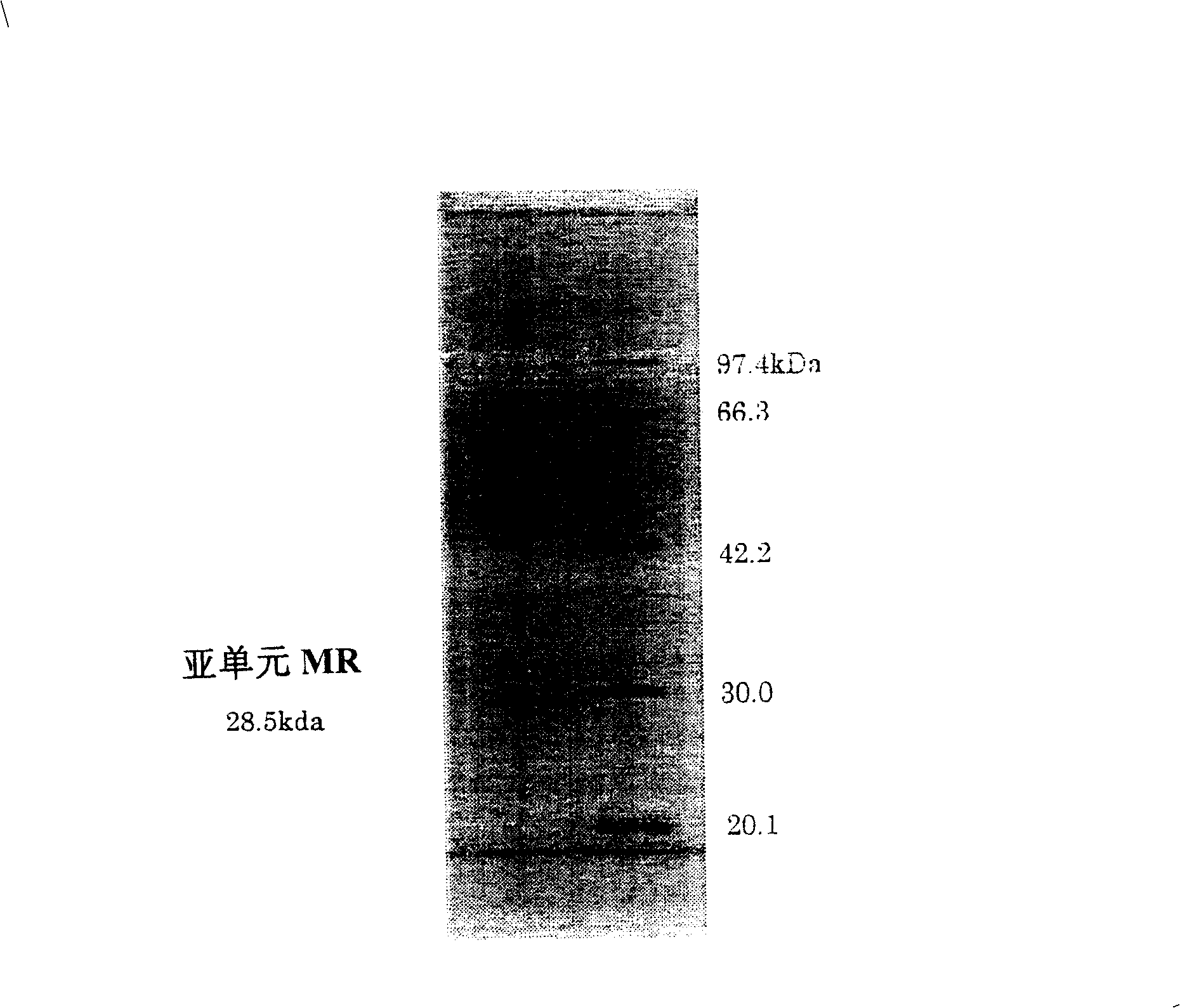 Aminoketone asymmetric reductase and nucleic acid thereof