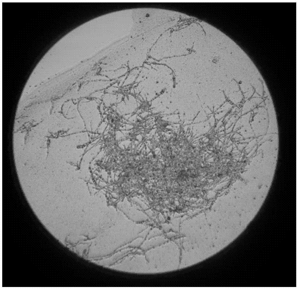 Mutant strain with high yield of Gamma-linolenic acid and preparation method and application of mutant strain