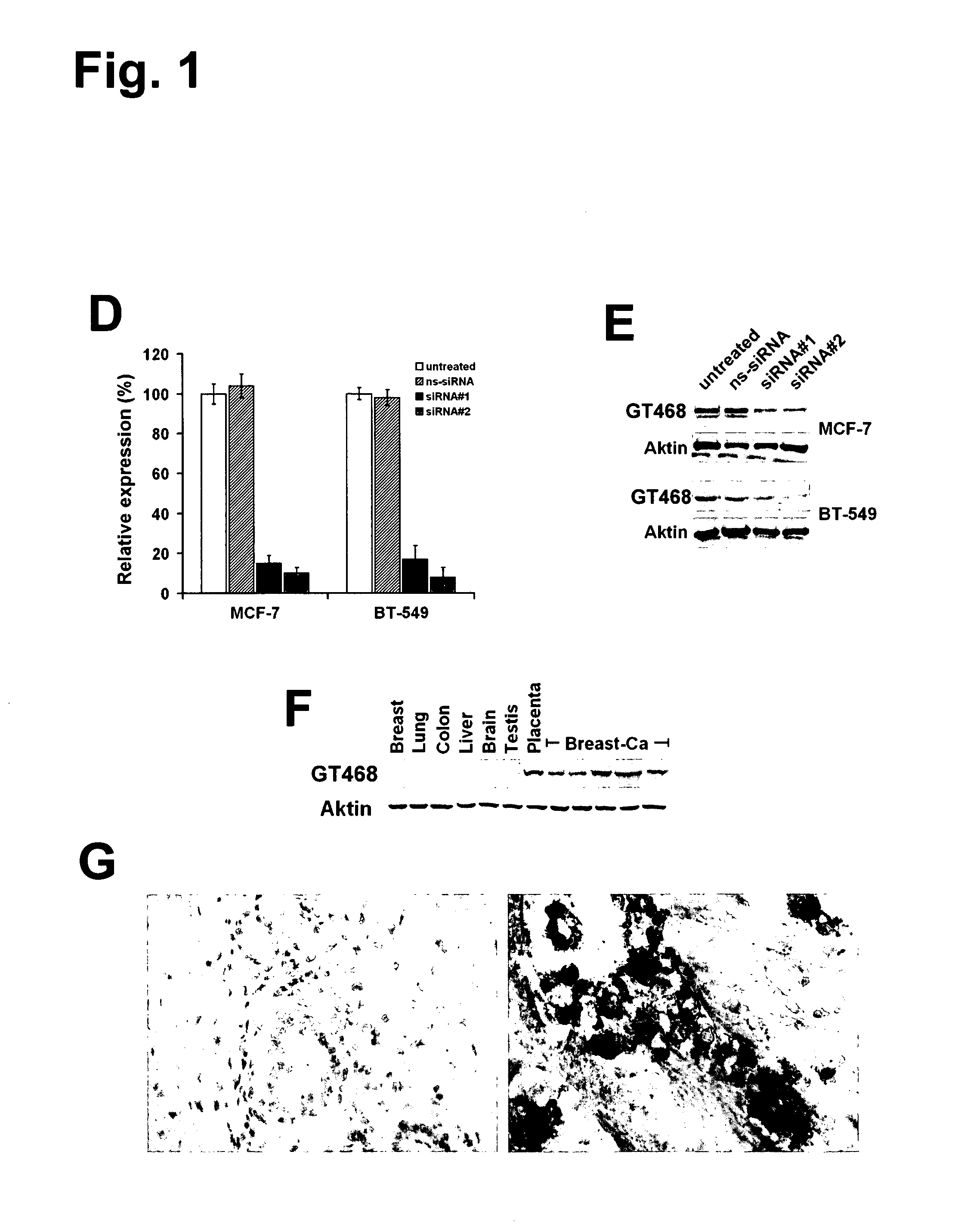 Monoclonal antibodies for treatment of cancer