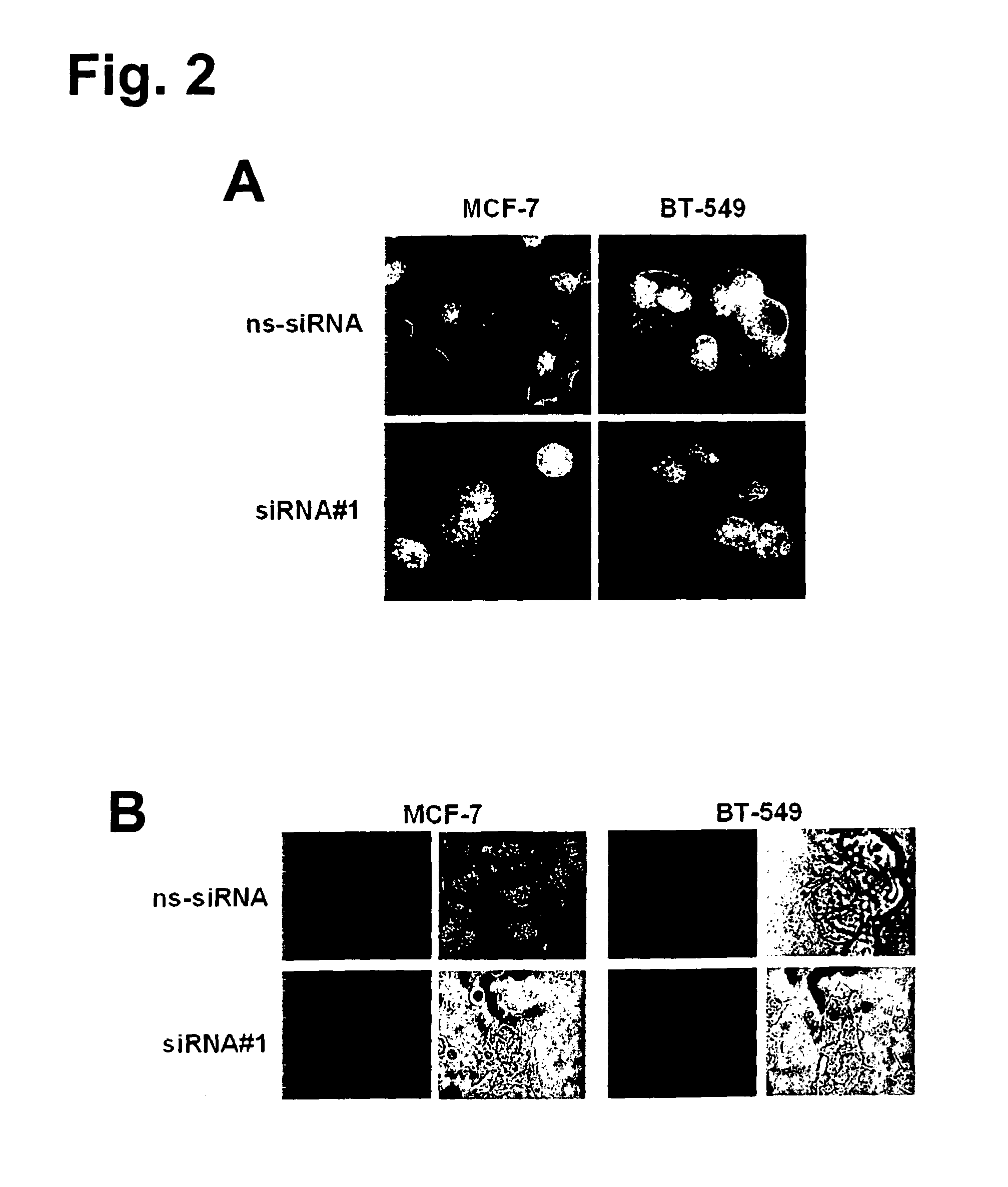 Monoclonal antibodies for treatment of cancer