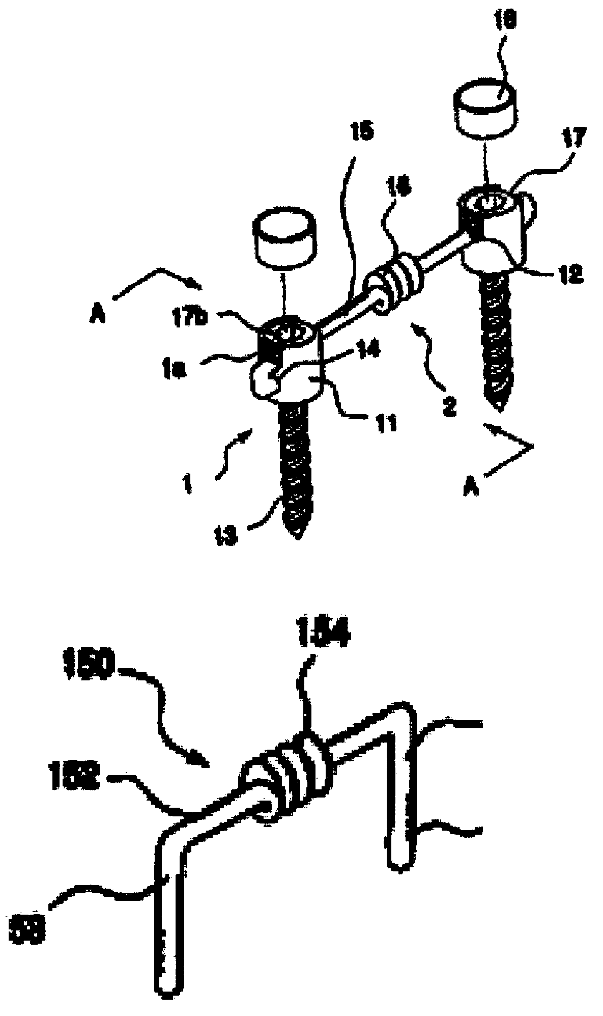 Dynamic stabilization implanting unit for spine