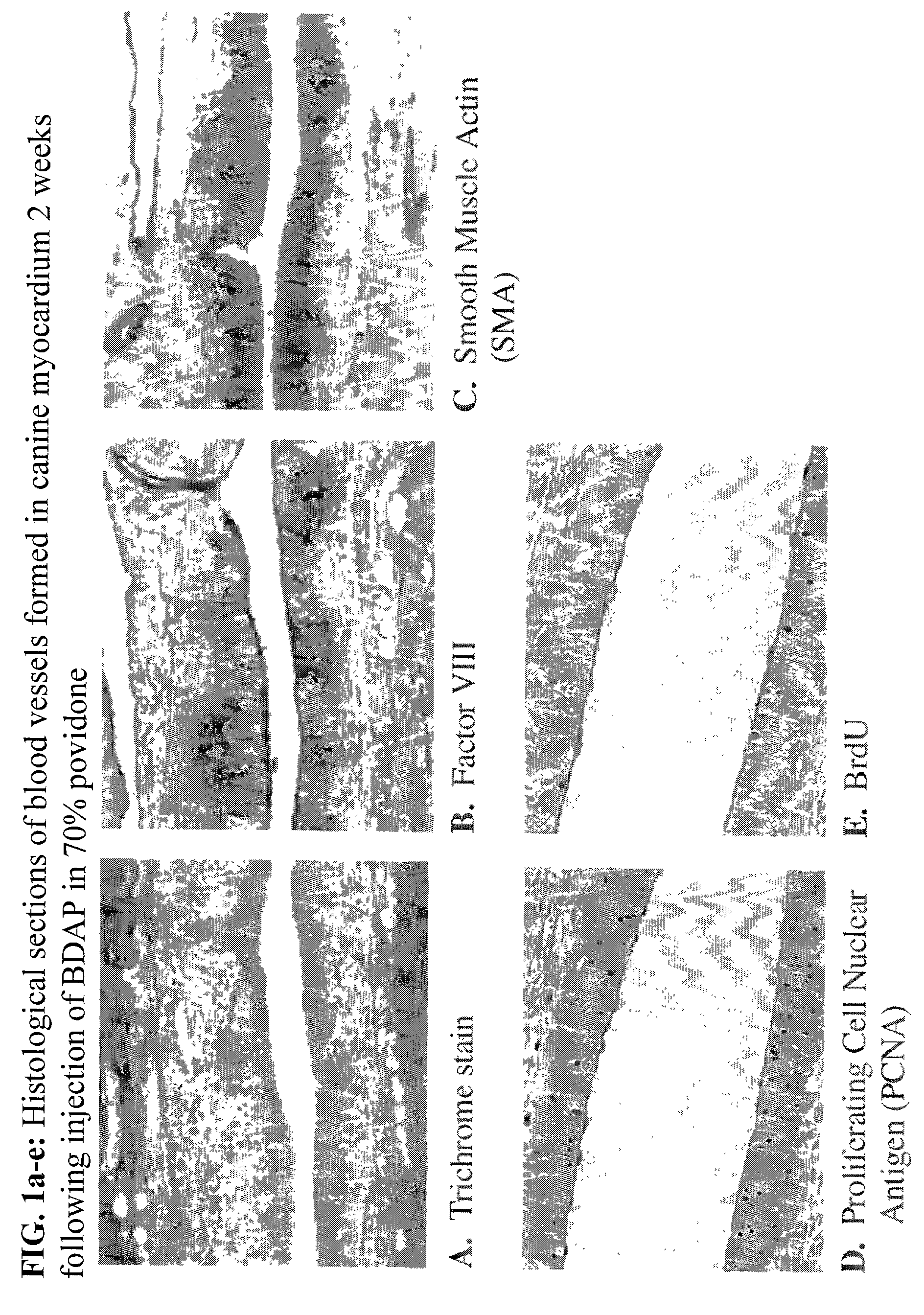 Povidone-containing carriers for polypeptide growth factors