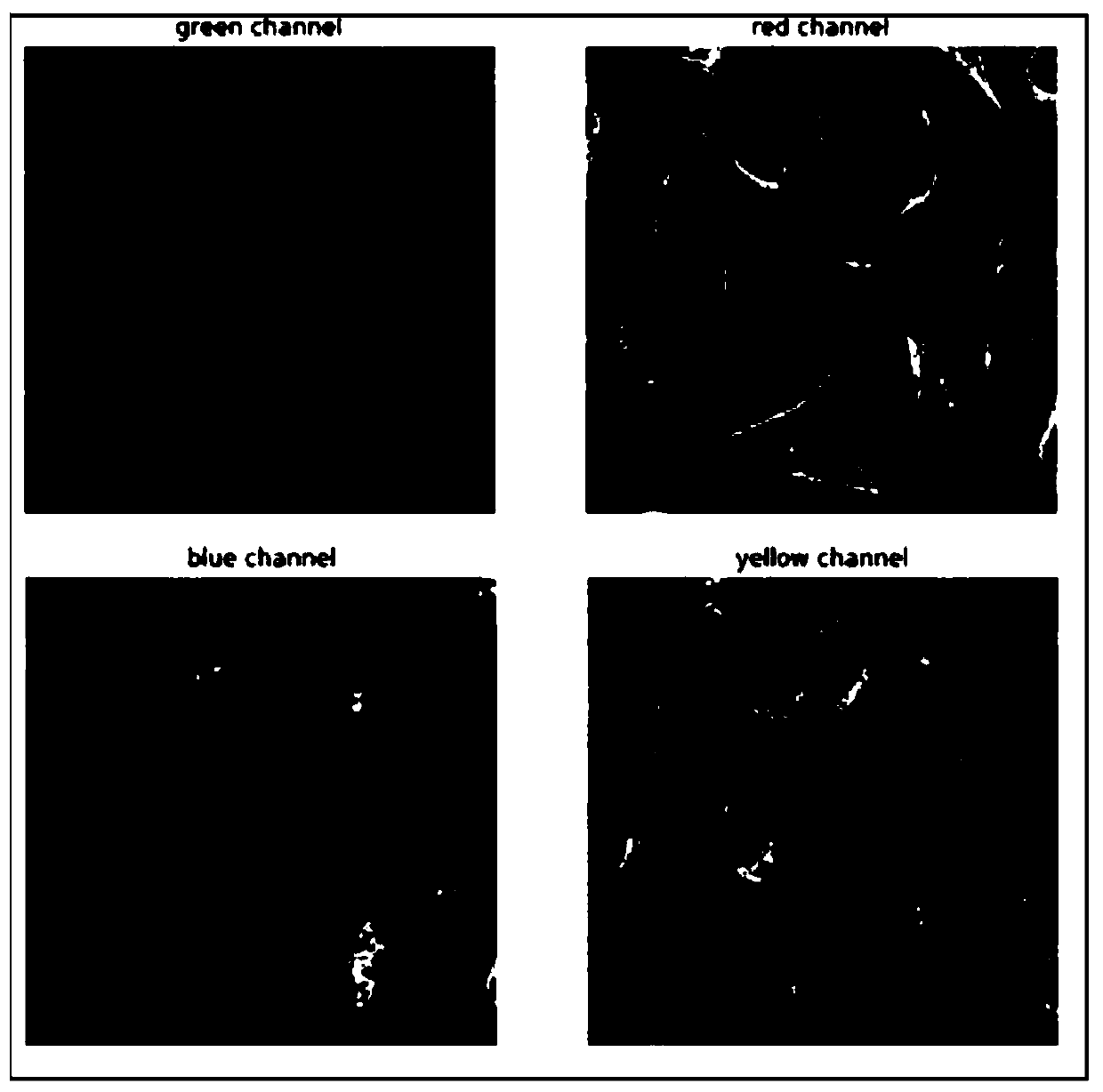 A convolutional neural network-based human body cell protein automatic identification method and system