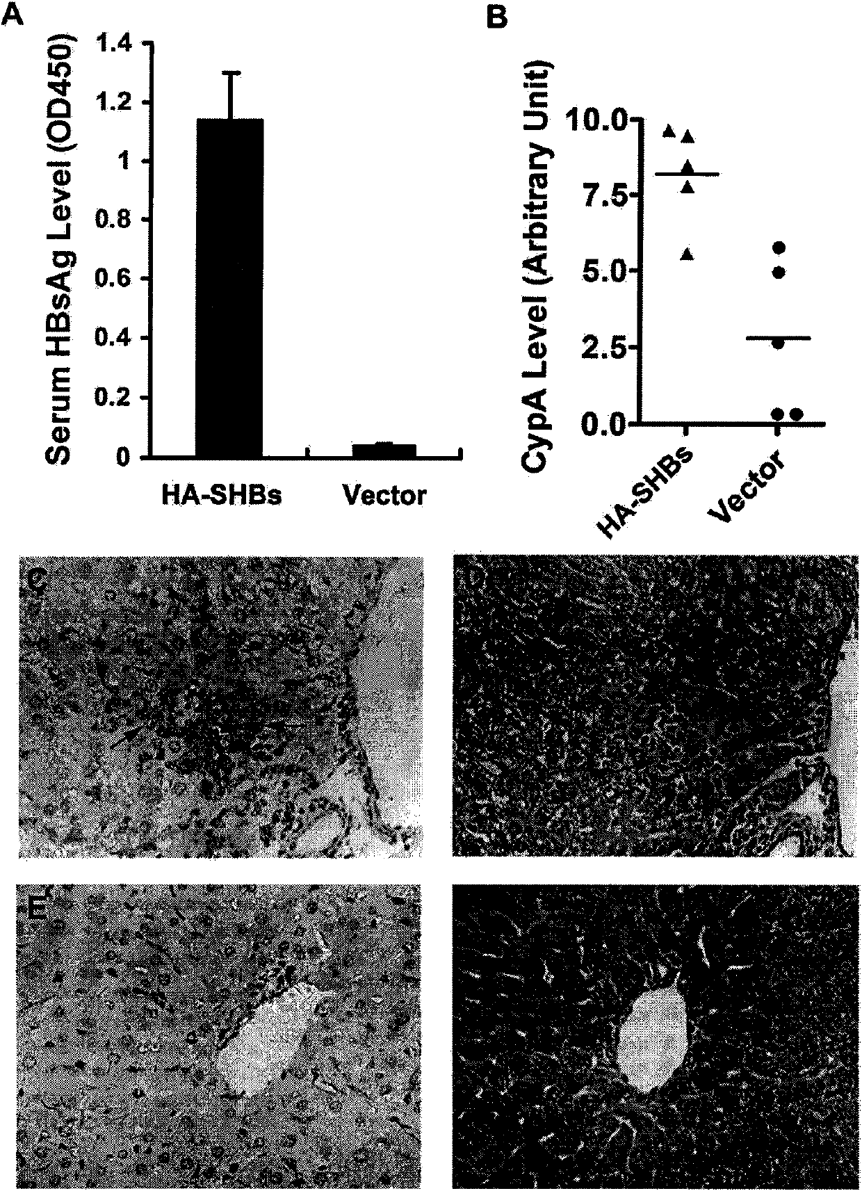 Serum maker of HBV (hepatitis B virus) infestor and application thereof