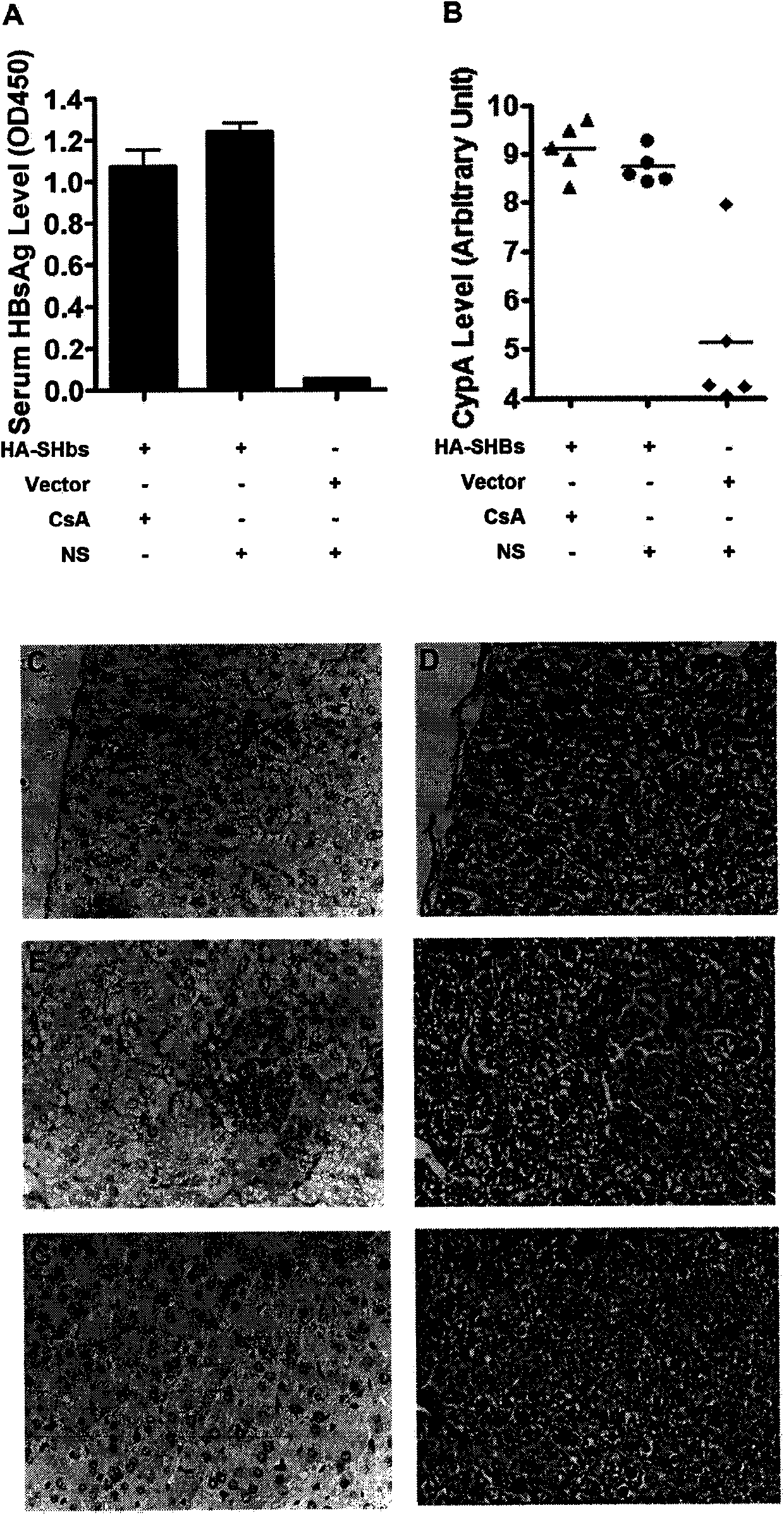 Serum maker of HBV (hepatitis B virus) infestor and application thereof