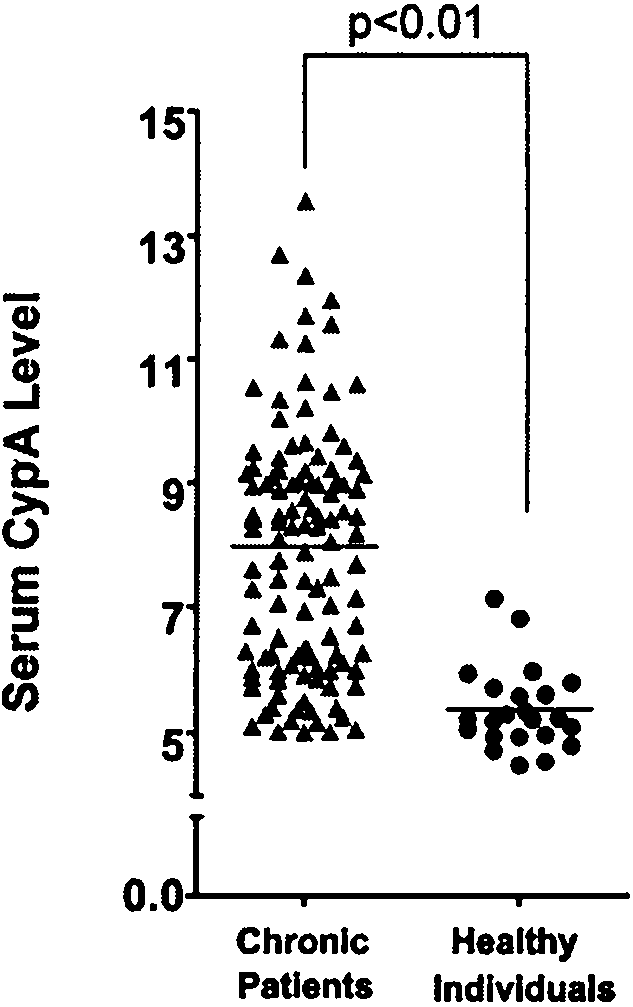 Serum maker of HBV (hepatitis B virus) infestor and application thereof