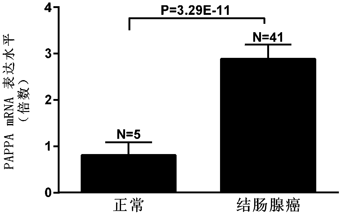 Biological marker for detecting colorectal cancer and application thereof