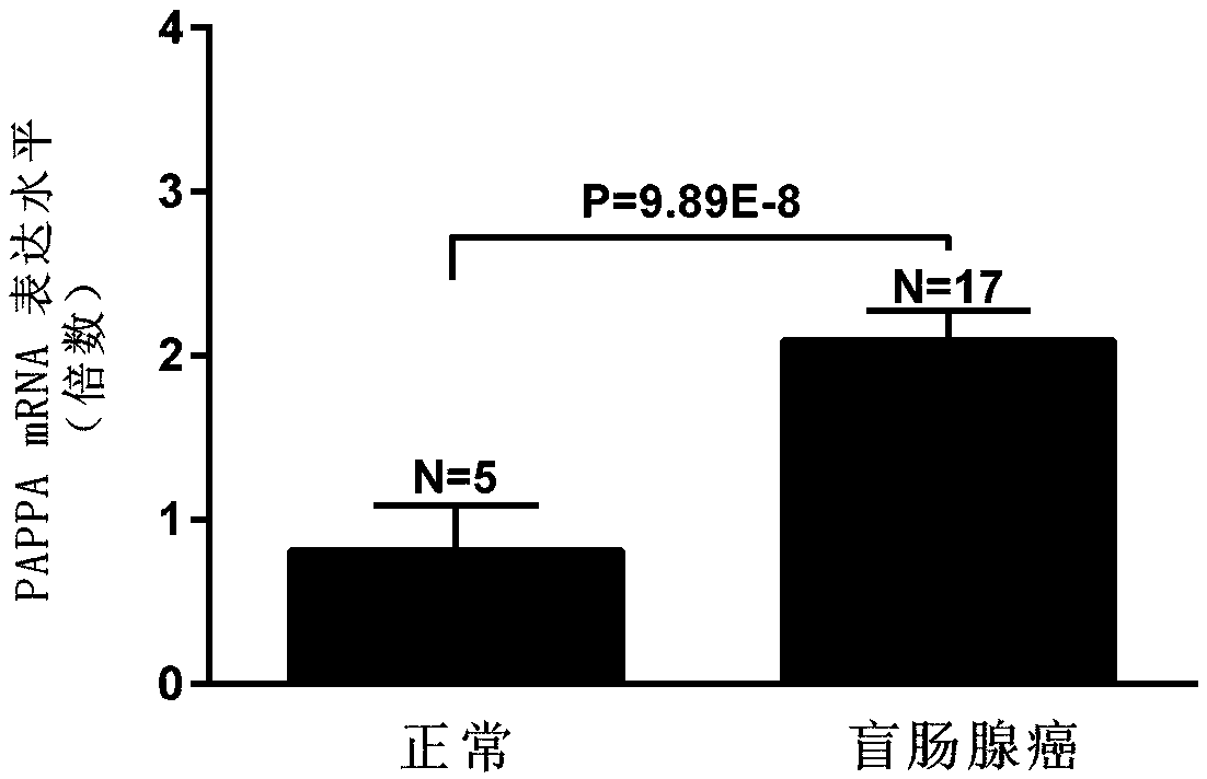 Biological marker for detecting colorectal cancer and application thereof