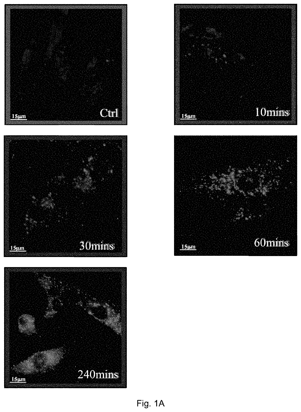 Method of treating refractory rheumatoid arthritis associated with p53 mutation