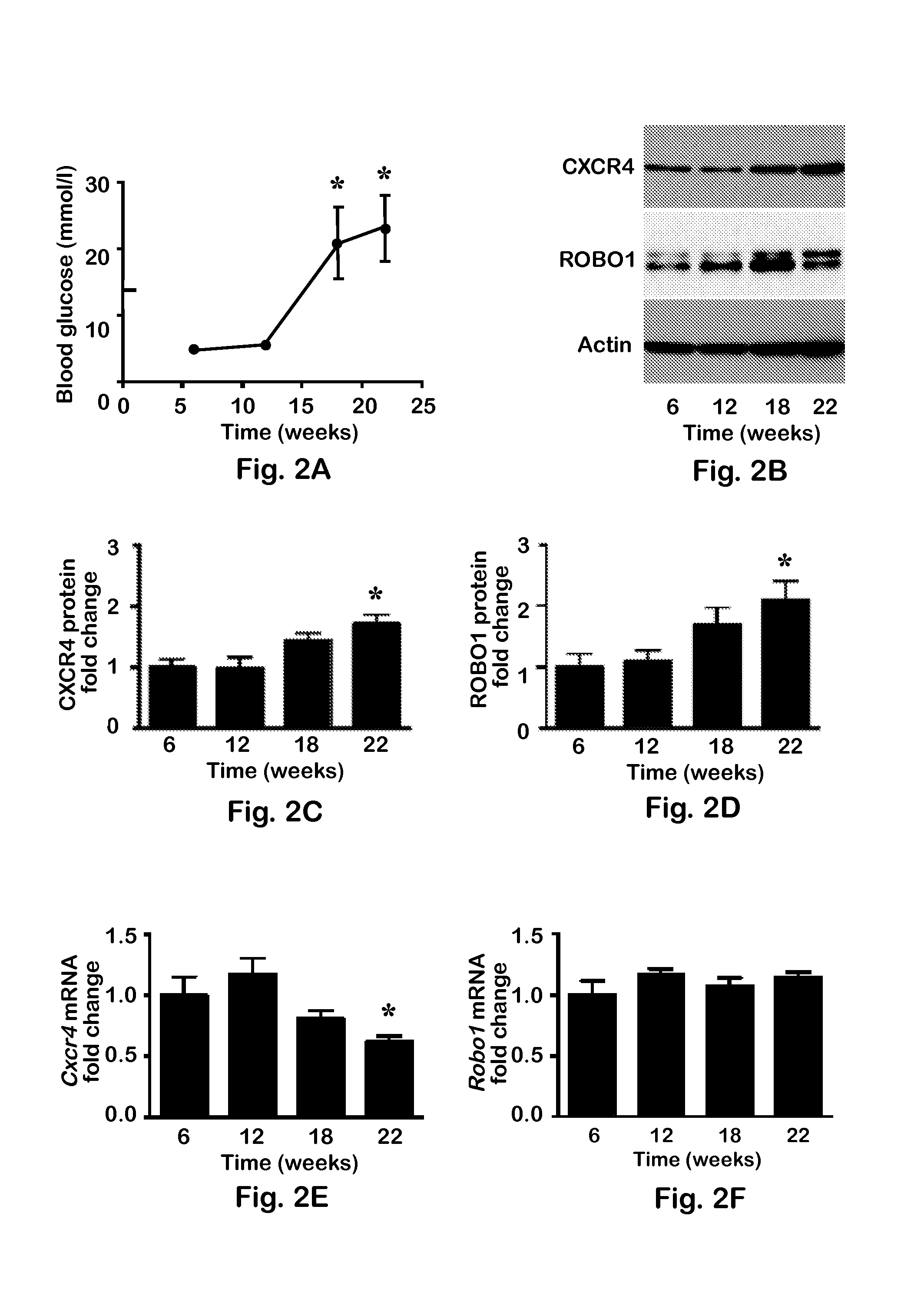 Cxcr4 and robo1 expression as markers for autoimmune diabetes