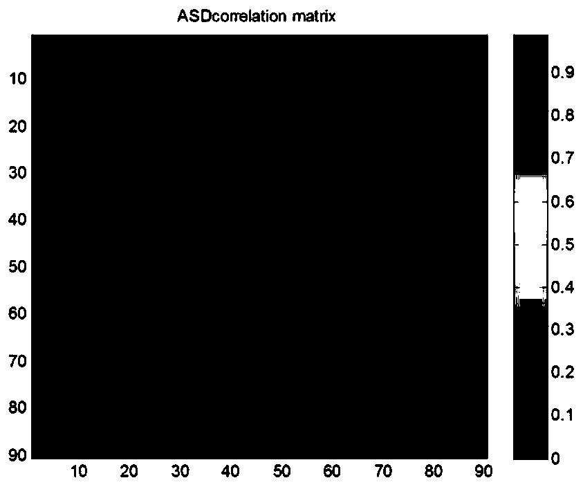 Brain structure network model analyzing method for teen-age autism