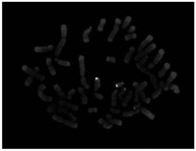 Method for detecting translocation fragment monomer or trisome in latent balance translocation carrier embryo