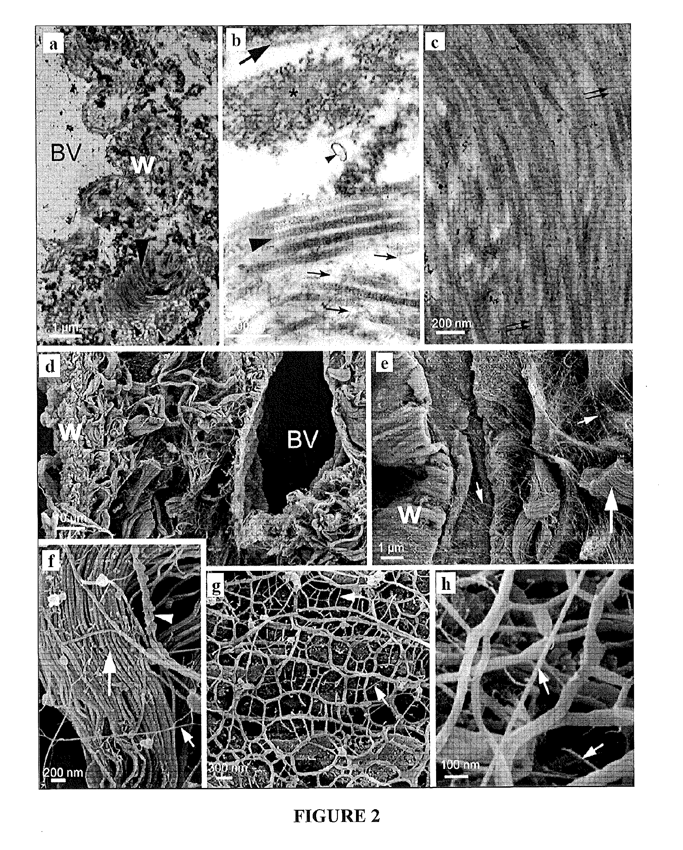 Biomatrix Scaffolds