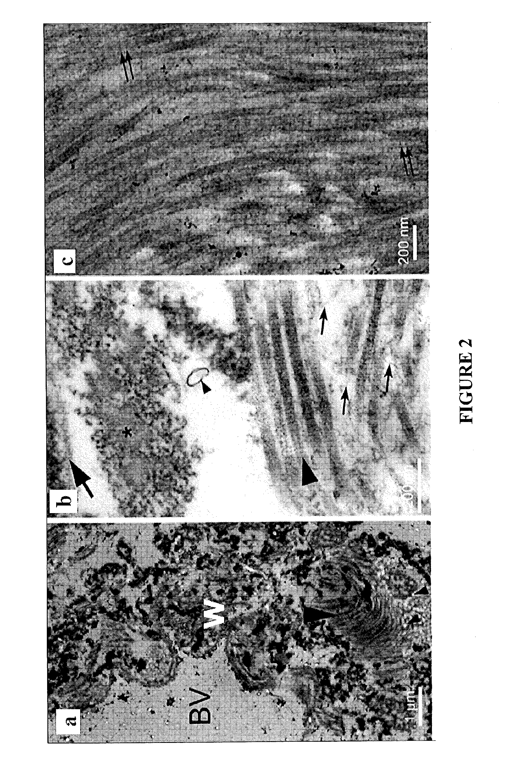 Biomatrix Scaffolds