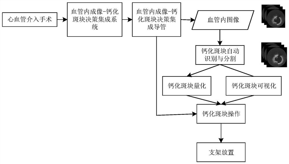 Calcified plaque detection decision system and device based on artificial intelligence algorithm