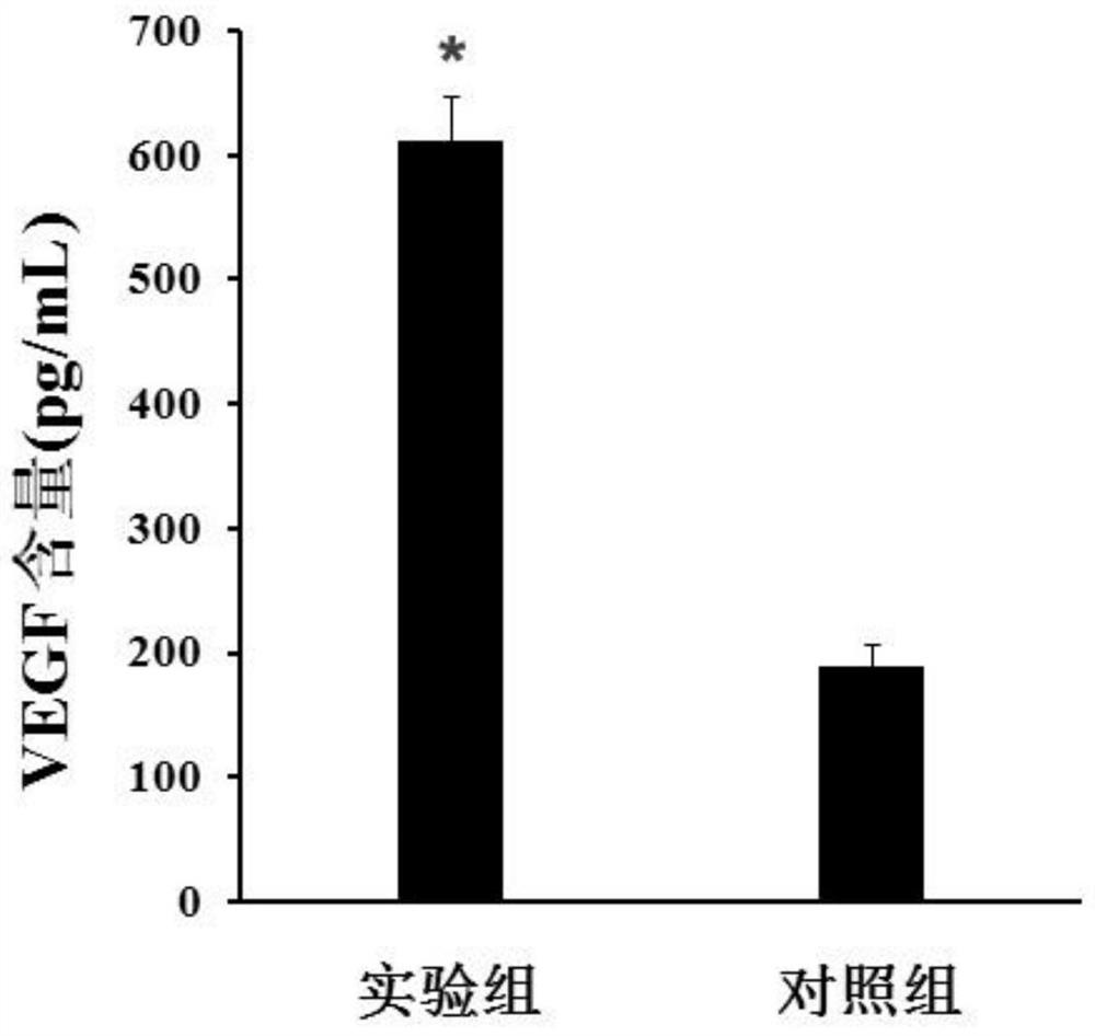 Preparation method of biogel and biogel prepared by preparation method